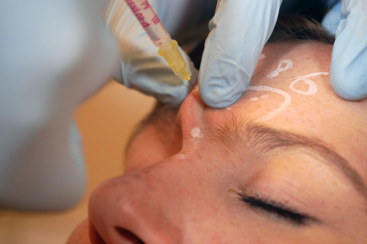 Die Injektionstechniken für die häufigsten Botox-Behandlungen - hier ist die Zornesfalte das Ziel - werden detailliert besprochen und geübt.