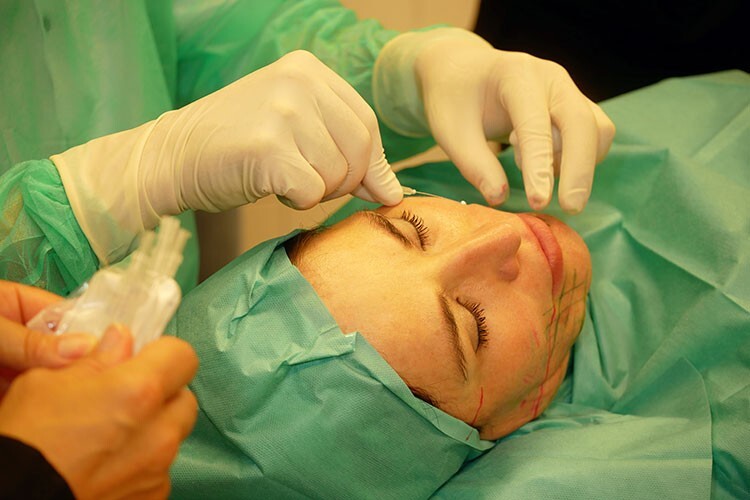 Fadenlifting (Online-Schulung für Ärzte)