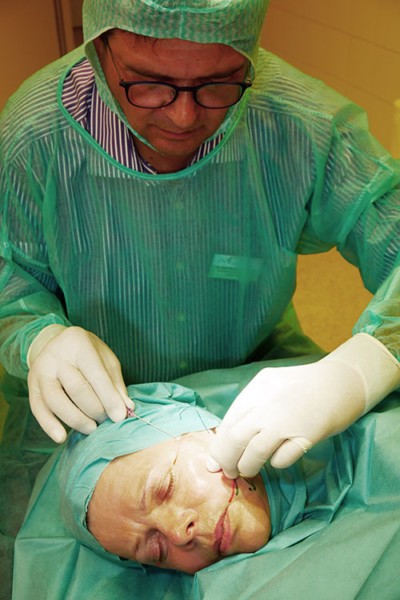 Verschiedene Fäden ermöglichen beim Fadenlifting unterschiedliche bzw. unterschiedlich starke Effekte.