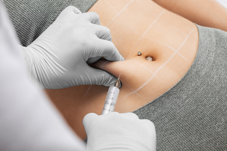 Injektions-Lipolyse (Online-Schulung für Ärzte)