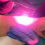 Die Fortbildung dient dem Erlangen der Fachkunde Laser für Ärzte nach NiSV auf Basis der Muster-Fortbildungsordnung der Bundesärztekammer.